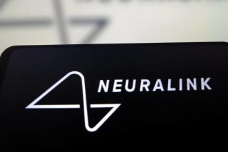 Mujer paralítica revela el impactante efecto del chip cerebral de Neuralink (VIDEO, FOTOS)